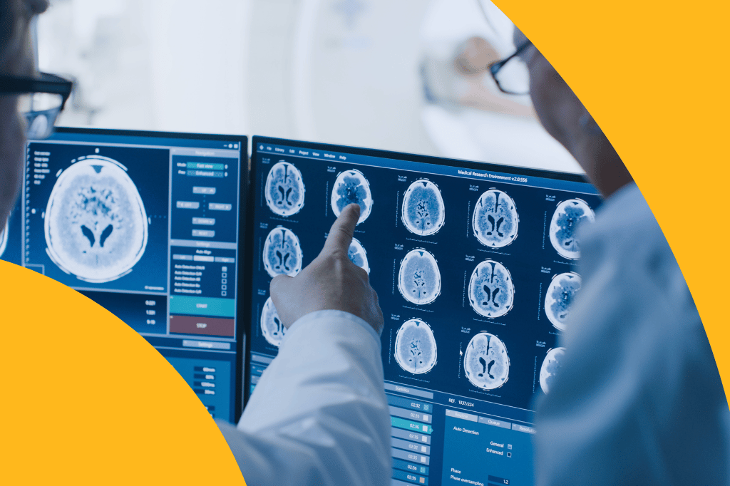 Hypertension during the Acute Phase of Stroke